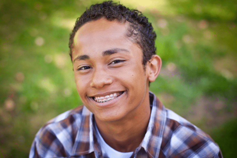 Adolescent orthodontic treatment at Advanced Orthodontics in Mercer Island, Washington